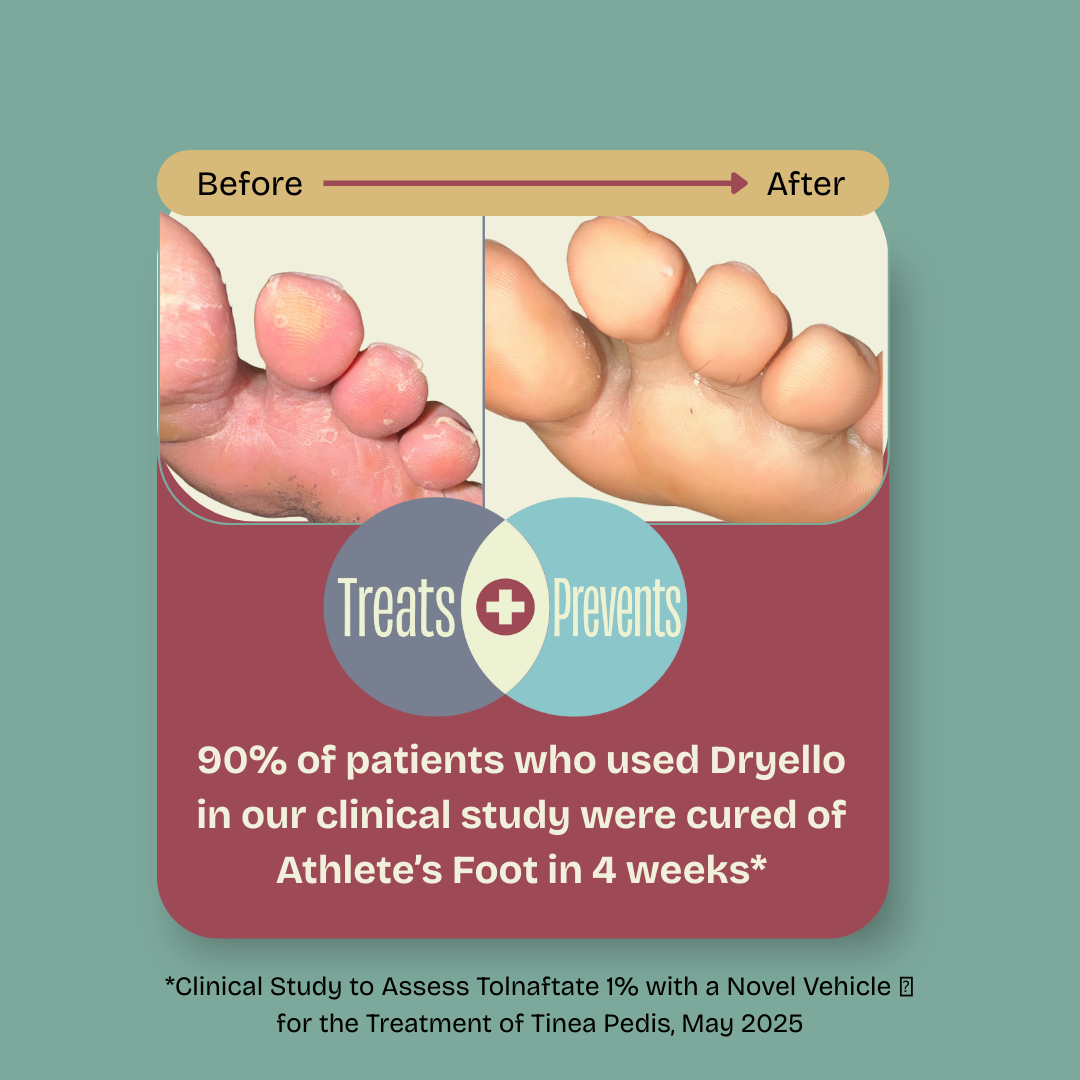 Dryello's Clinical Study with image of foot before and after athlete's foot treatment