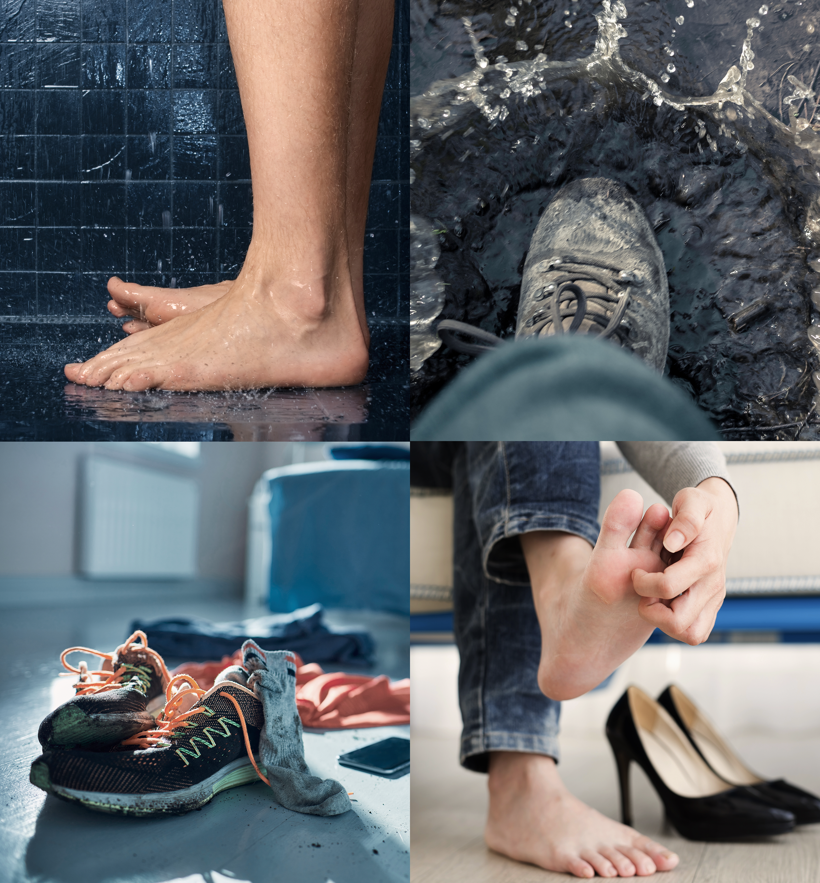 Itchy Feet. Understanding What Causes Athlete's Foot Disease.